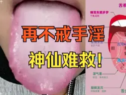 Download Video: 【舌诊案例】男人最怕这种舌象，再不戒手淫，神仙难救！