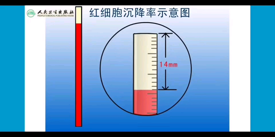 生理学红细胞沉降率