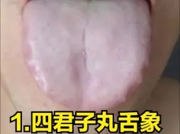 Video herunterladen: 脾虚后，四君子、六君子、香砂六君子怎么选？