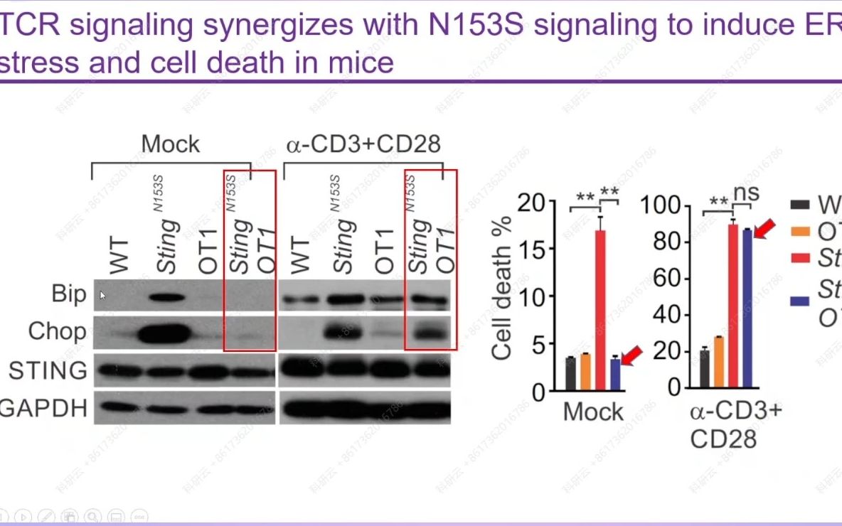 20230613克利夫兰诊所勒纳研究所邬建军STINGMediated T cell Death in Autoimmune Disease and Ca哔哩哔哩bilibili