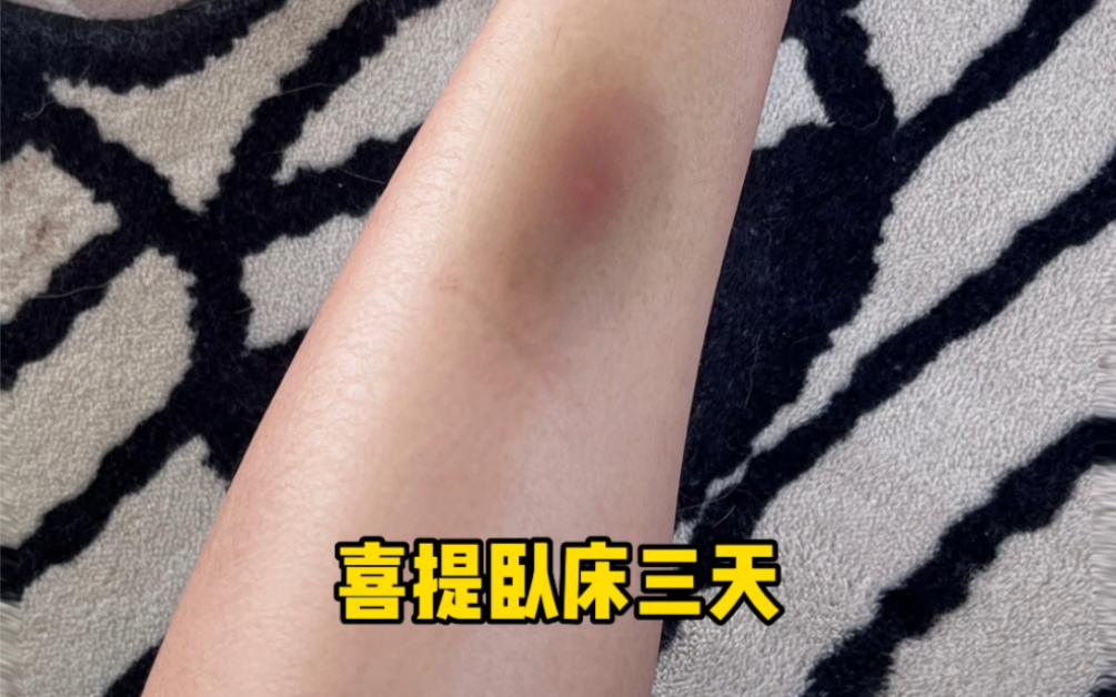 养大型犬没被撞伤踩伤过，都不完整。-赫兹是也-赫兹是也-哔哩哔哩视频
