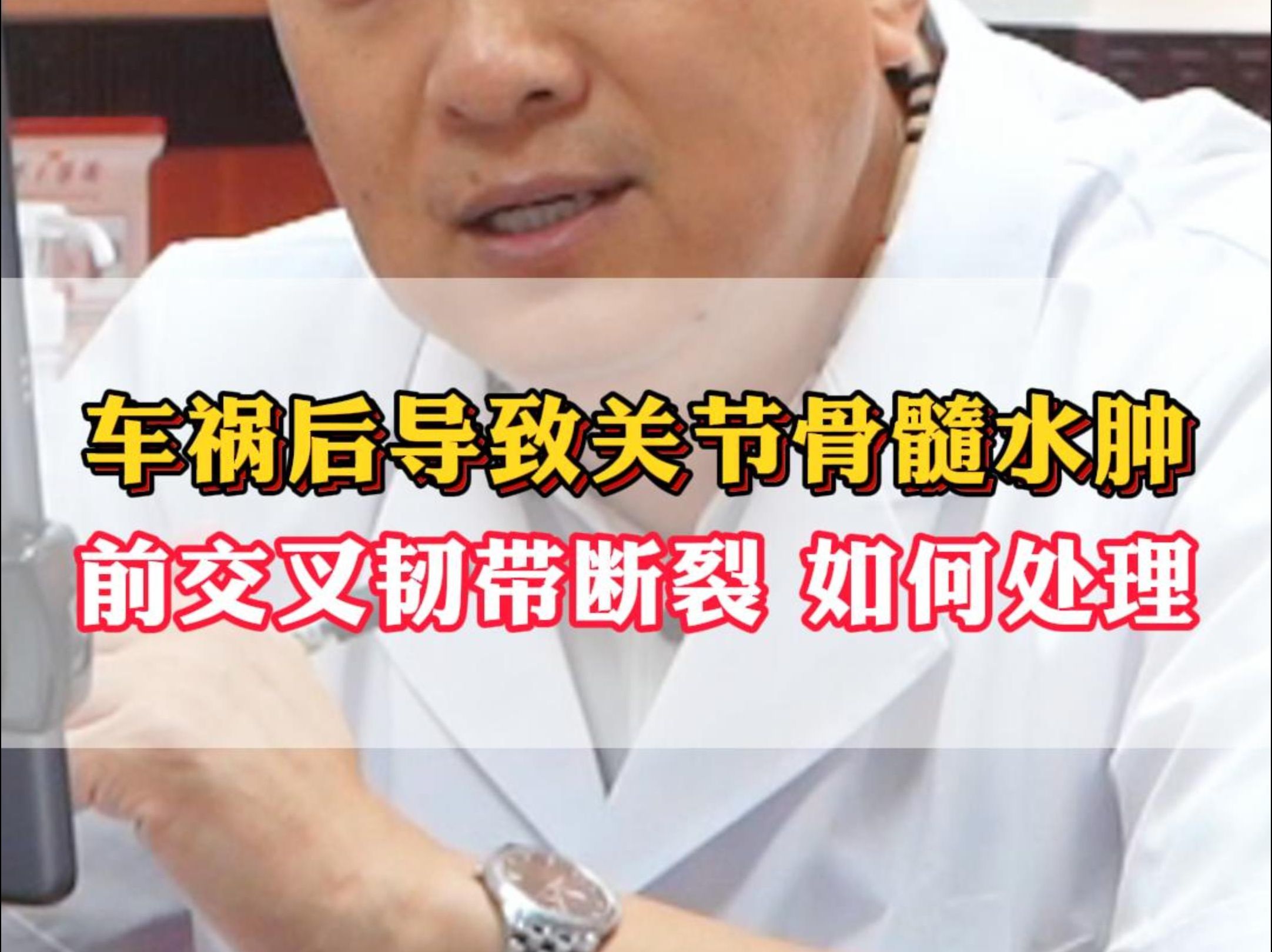 车祸后胫骨平台和股骨大面积骨髓水肿,前交叉韧带断裂,该怎么办