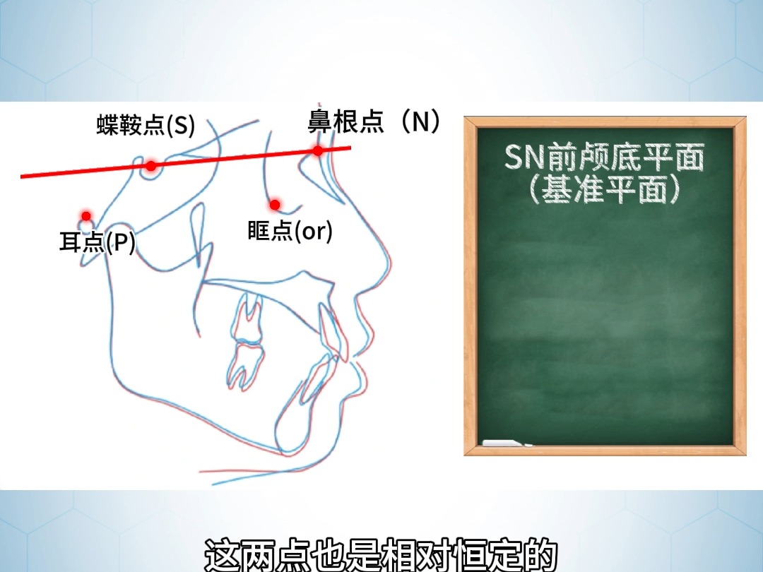 头影测量点位及骨性分析哔哩哔哩bilibili