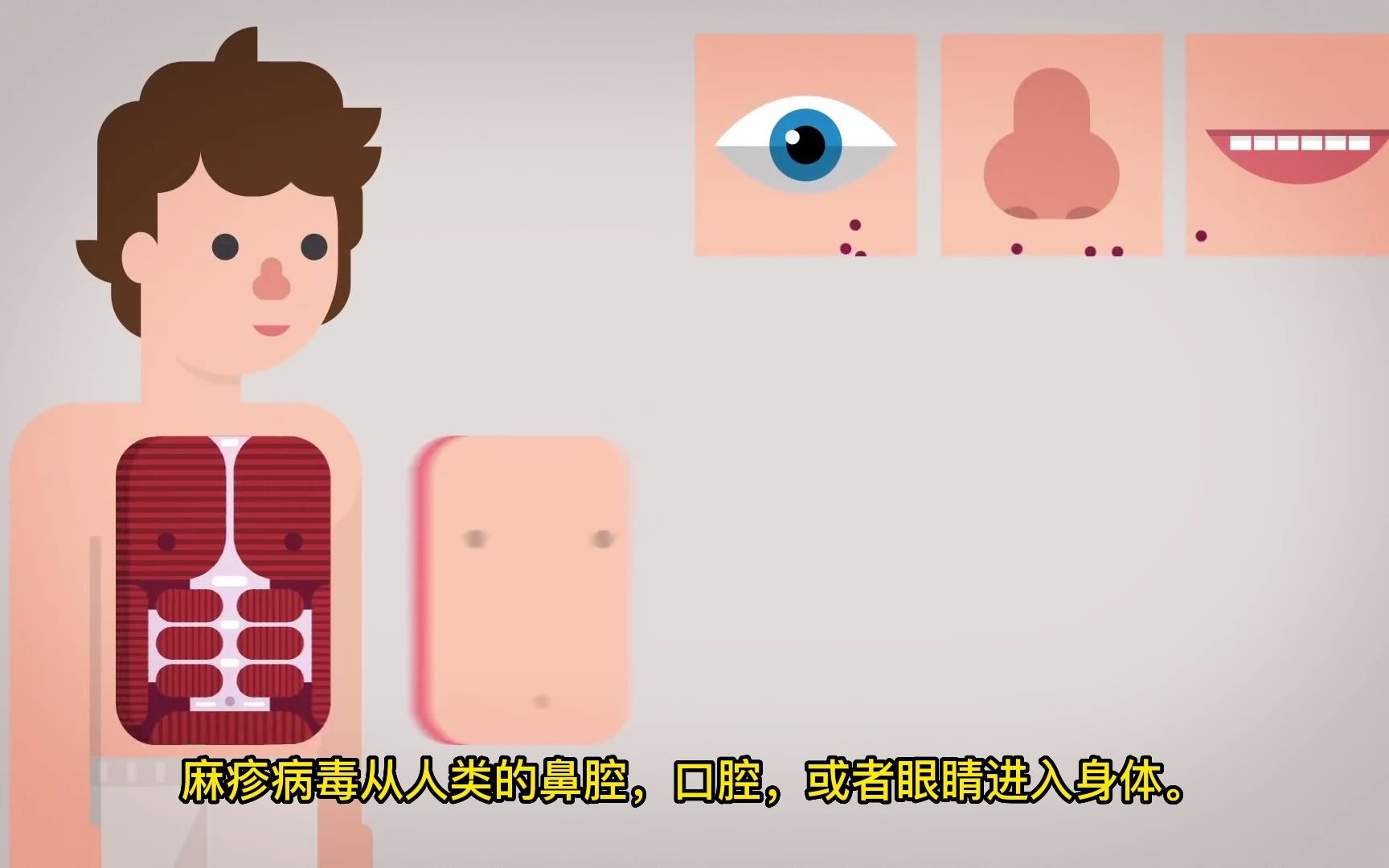 [图]麻疹解释 - 接种疫苗与否？Measles Explained-Vaccinate or Not