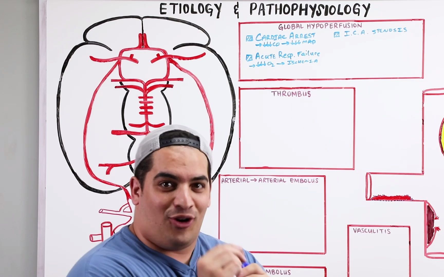 Acute Ischemic Stroke Etiology, Pathophysiology, Clinical Features, Diagnostics哔哩哔哩bilibili