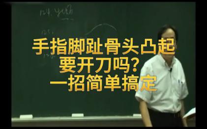 手指脚趾骨头凸起要开刀吗?一招简单搞定哔哩哔哩bilibili