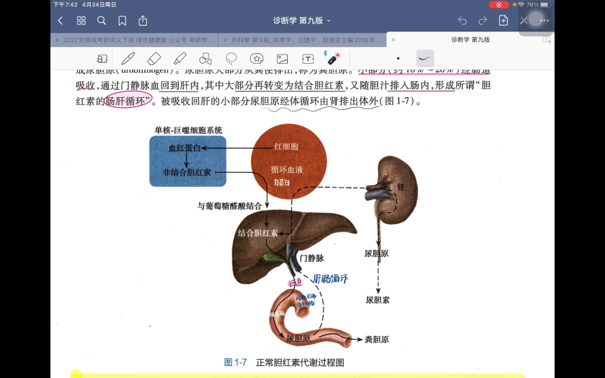 【胆红素的代谢】三种类型的黄疸形成过程哔哩哔哩bilibili