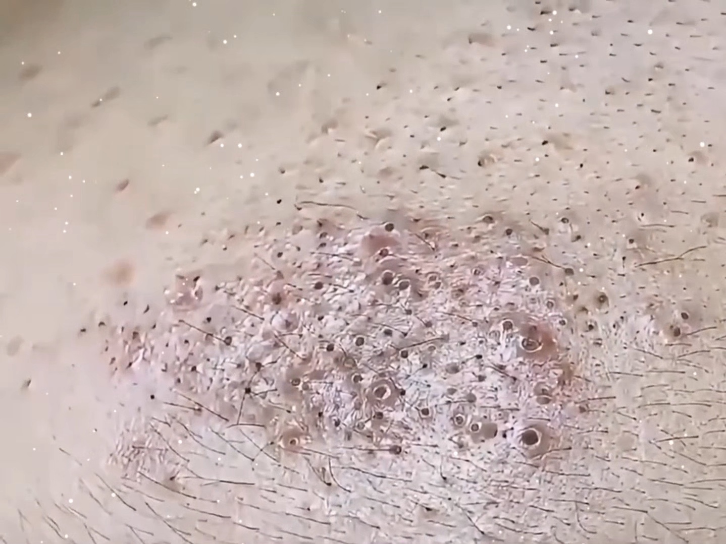 黑头上长了点脸