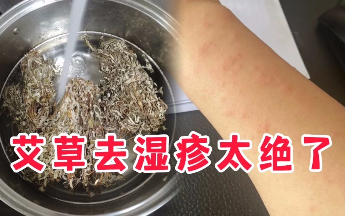 溼疹一招斷根沒再長!學到了