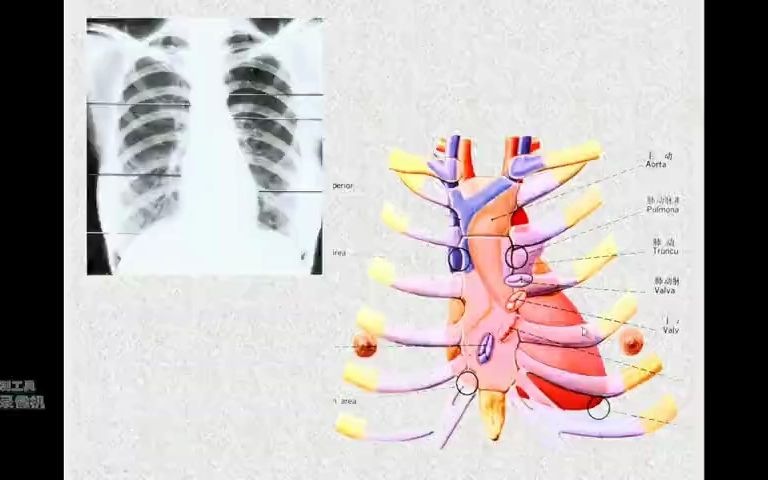 心尖体表图片