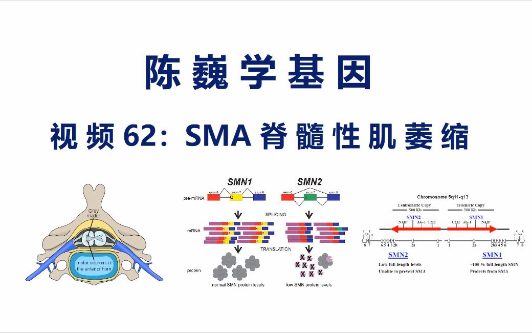 【陈巍学基因】视频62:SMA脊髓性肌萎缩哔哩哔哩bilibili