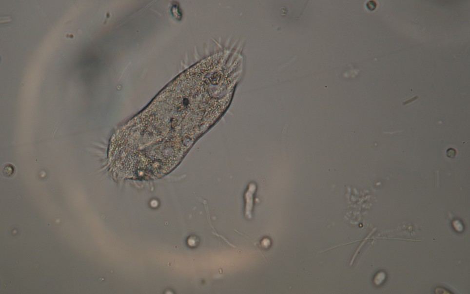 富藻淡水表层微生物 400x 纤毛虫吞了一只不小的硅藻,要消化不良了哔哩哔哩bilibili