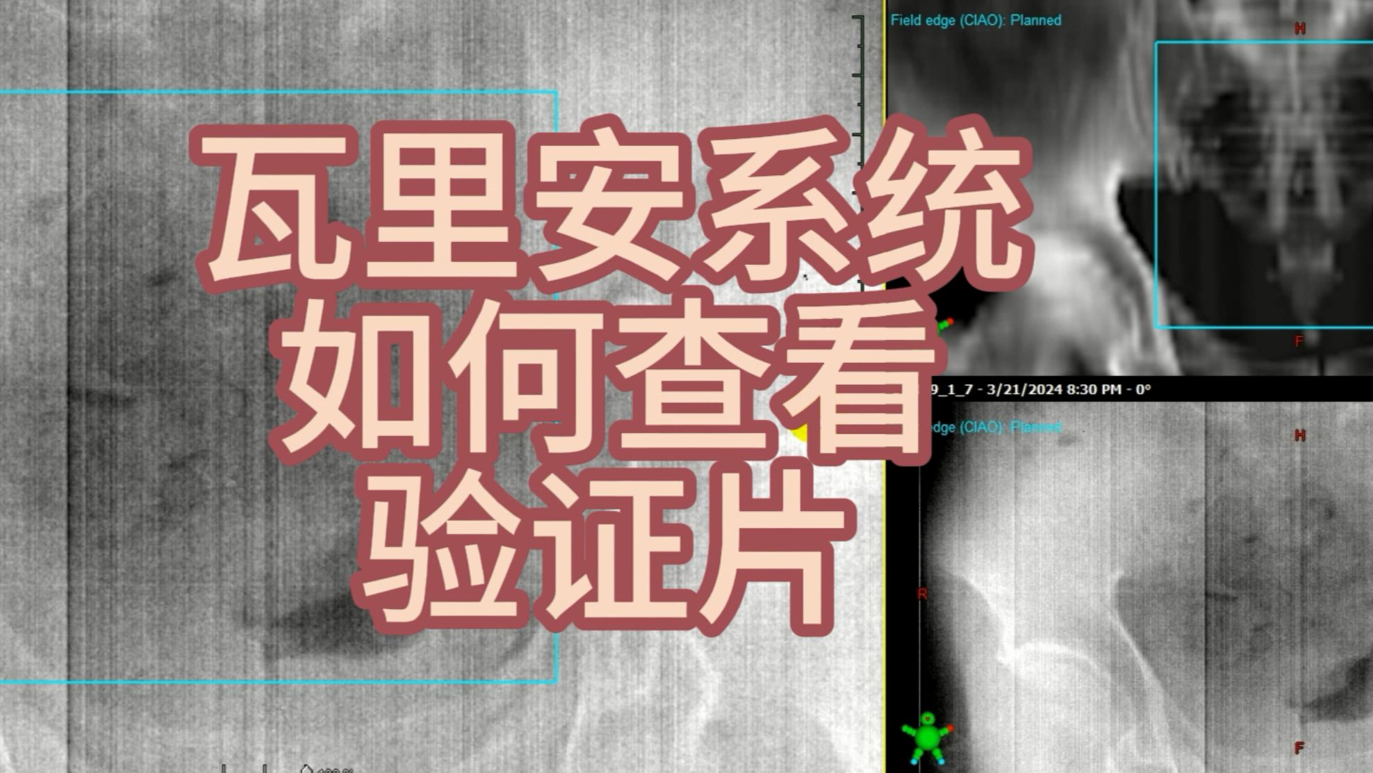 瓦里安放疗系统如何查看验证片