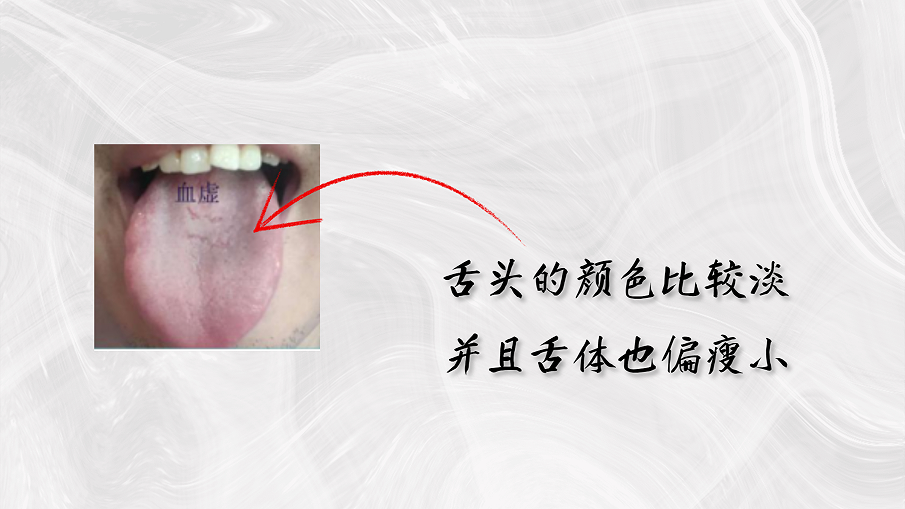 舌头有裂纹就是肾精亏虚?教你认识4种裂纹舌,简单一招修复它 - 哔哩哔哩