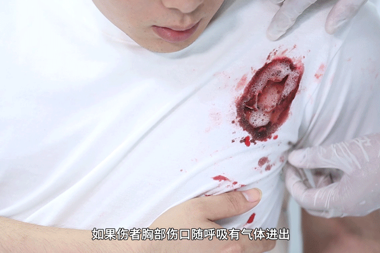 胸部外伤急救法