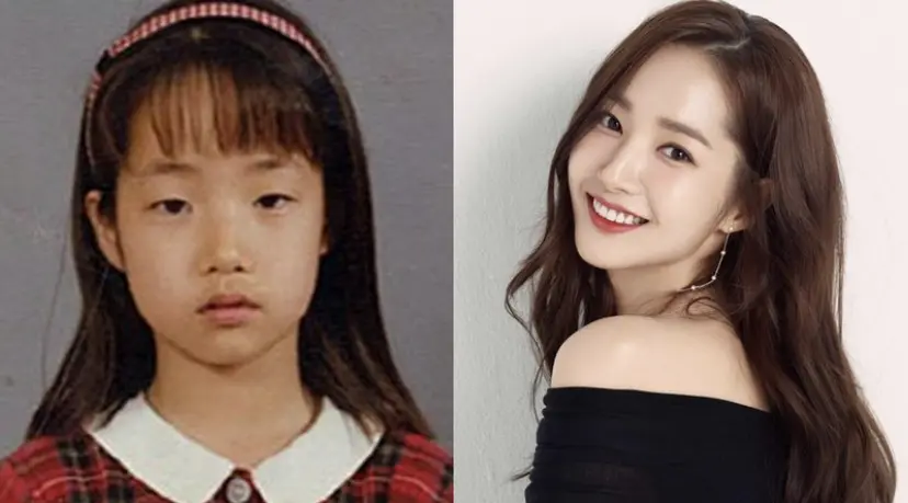 整容液 朴敏英整到变整形医院的范本 更有女明星不断进化变脸 坦言 像妖怪 哔哩哔哩