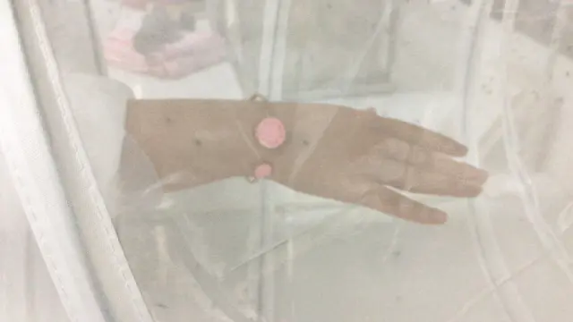 三类宝宝驱蚊手环测评：人肉测试，看看到底有没有用？