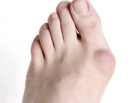 牛江红带您了解大脚骨原因