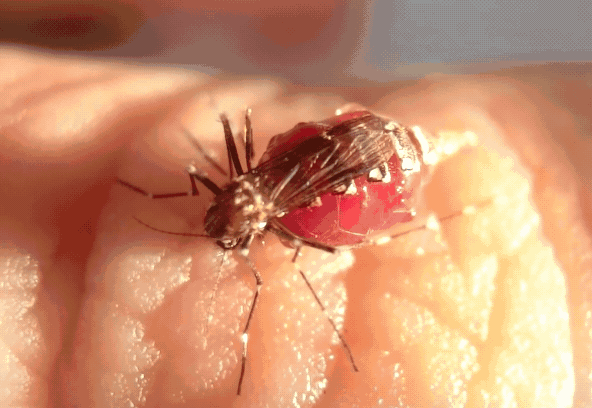吸血自爆的蚊子术前术后对比腹索神经位置
