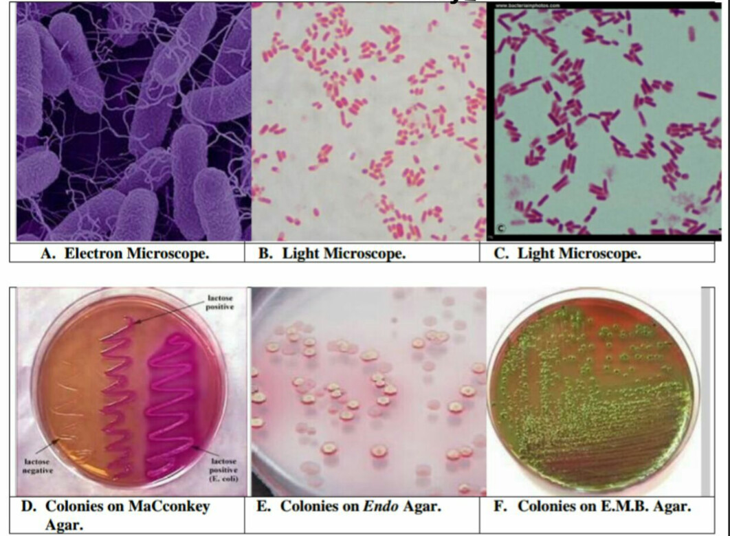 大肠杆菌图片素材-编号09915539-图行天下