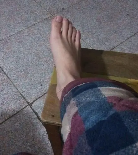 男朋友脚臭脱皮怎么办 用对方法最重要 哔哩哔哩