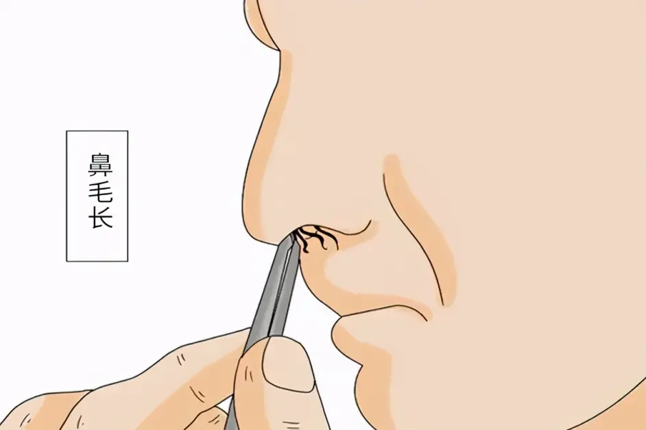 鼻毛长着长着就窜出来 能剪掉或拔掉吗 鼻毛为什么会窜出来 哔哩哔哩