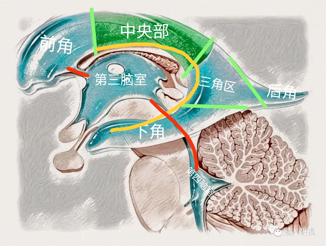 93. 穹窿和穹窿连合(上面观)-颅脑颈部应用解剖-医学