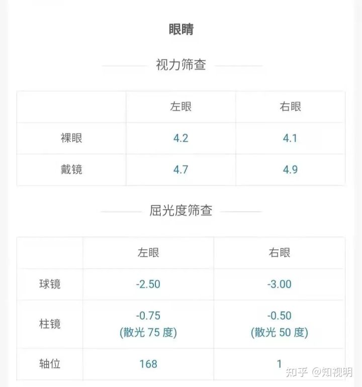 OD体育官方网站- OD体育APP下载- 世界杯指定投注平台ADD 值体现的是在看近时需要额外增加的正球镜度数。人眼随着年龄增长晶状体的弹性逐渐下降调节能力也随之减弱导致看近处物体时会出现困难这种情况被称为老视也就是我们常说的老