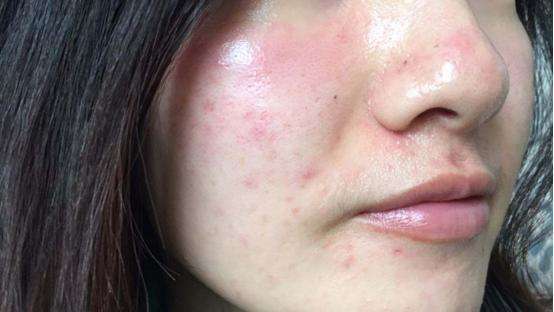 dr.mu一套ko秋季干敏,打造轻盈水嫩"仙女肌"