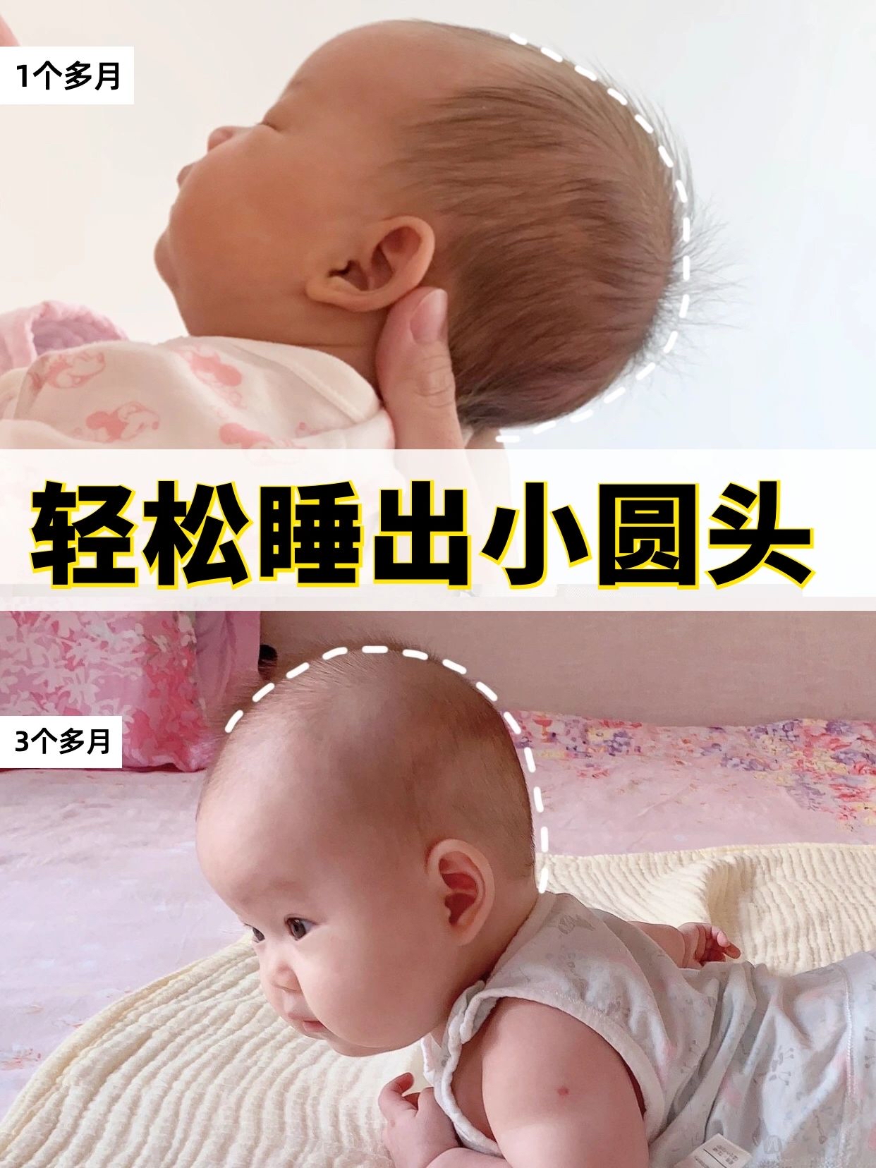 婴儿睡头型几个月定型（宝宝头型扁）-幼儿百科-魔术铺