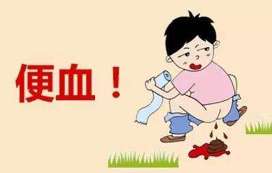 患上痔疮后,什么情况下需要做手术?医生告诉你答案