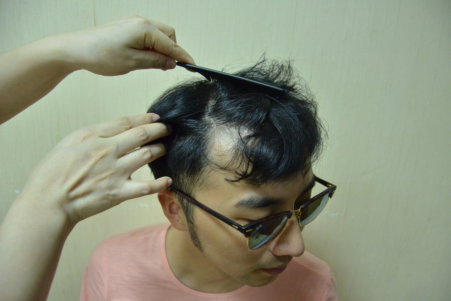 90后脱发大军还好吗?6个人人都用得上的防脱发攻略来了