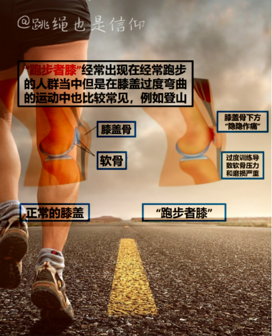跑步健身膝盖痛怎么回事?