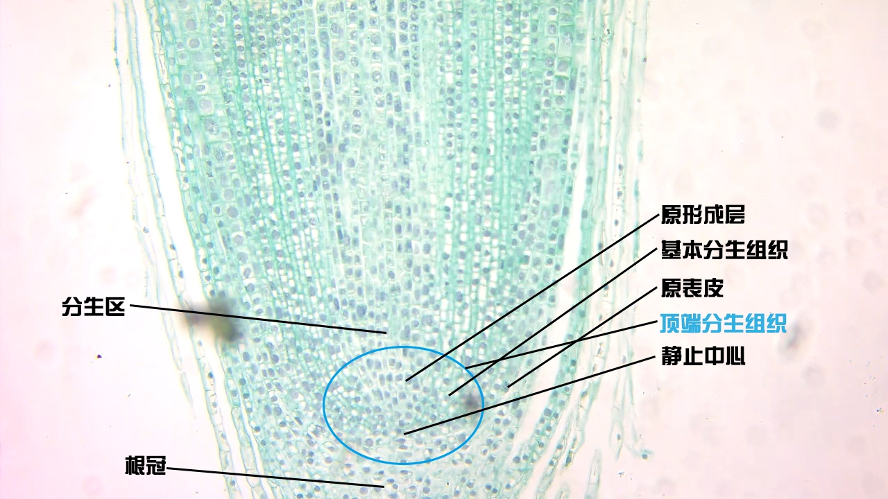 洋葱根尖细胞 结构图图片