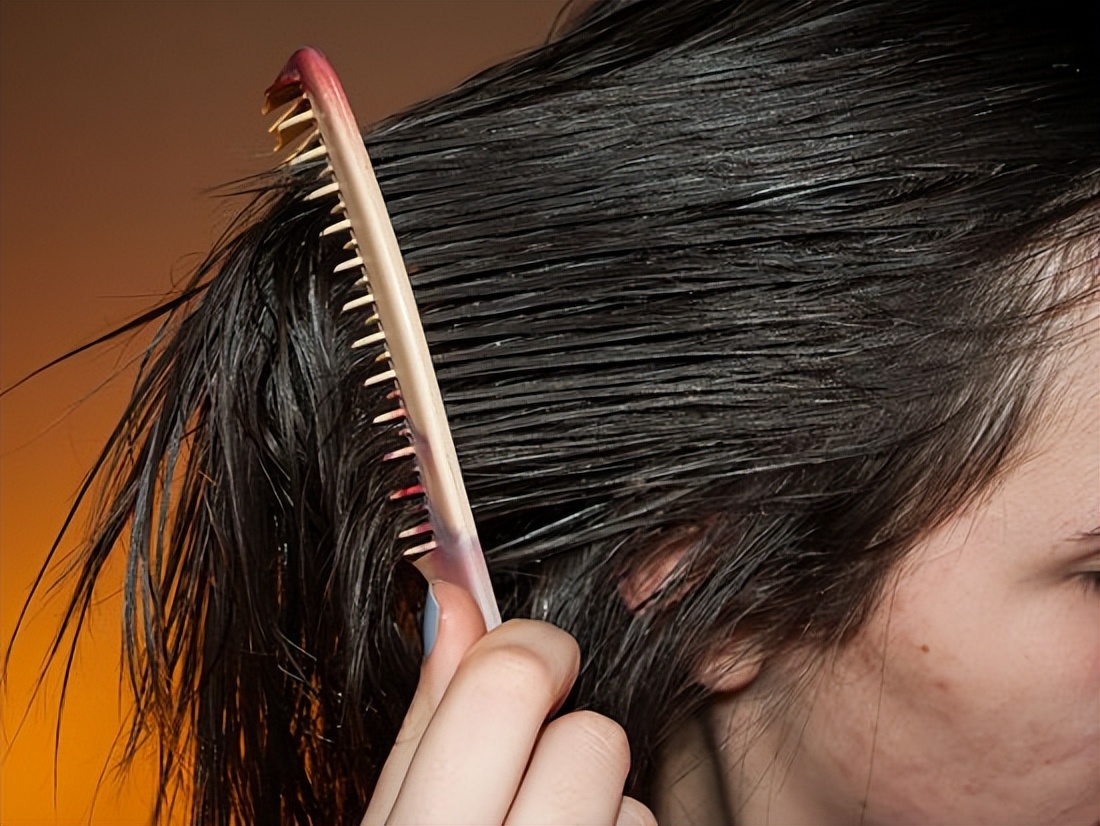 种头发可以保持多久时间，植发后能保持多久呢