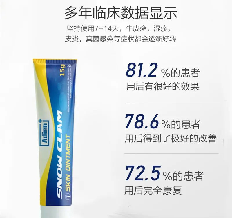 瑞士安普敏皮肤膏治疗皮炎效果怎么样 能治好吗 除了治疗 还要做好这3点才好得快 哔哩哔哩