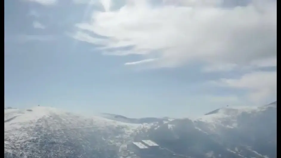 为什么会一只眼睛近视一只眼睛正常 眼睛散光100度怎么办 哔哩哔哩