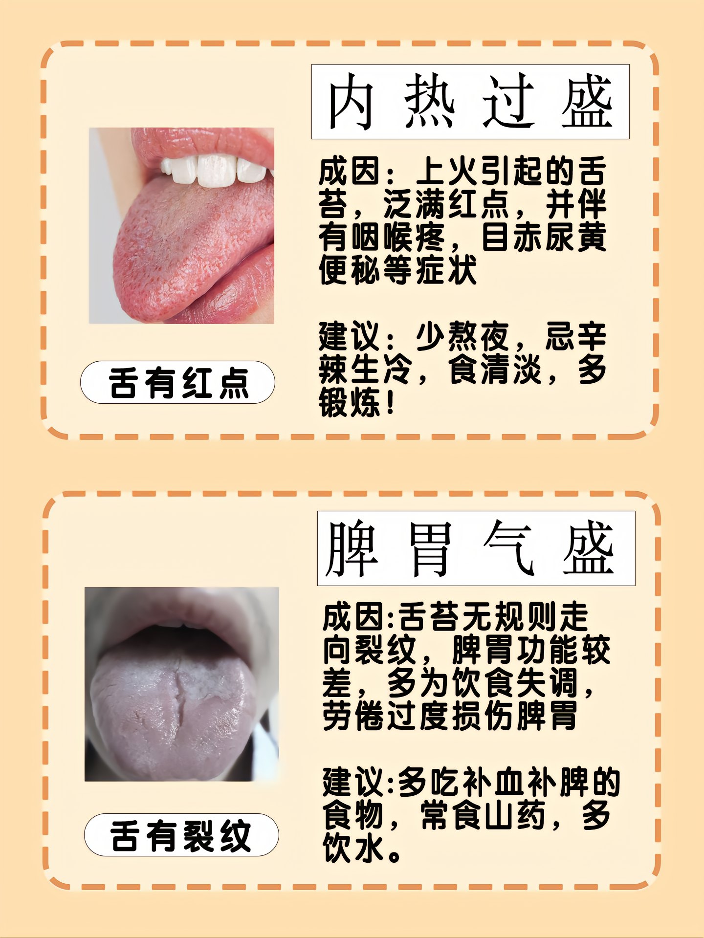 如何通过舌苔来判断身体健康与否？最全舌像来了，一分钟教你学会所有舌像！ - 知乎