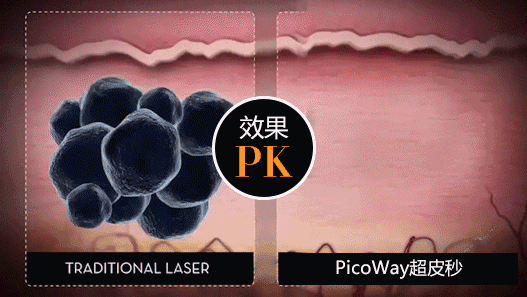 一,纹身真的能彻底从皮肤上清洗干净吗?