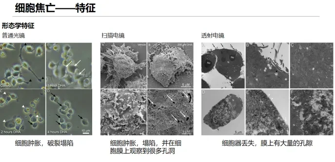 细胞焦亡重点详解 | 看完研究思路直接打开! - 哔哩哔哩