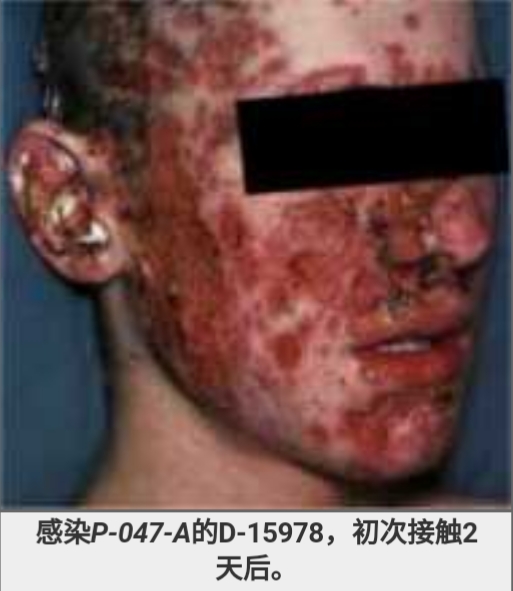 SCP-047 微生物诱变剂
