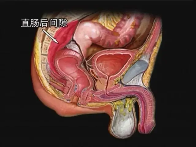 直肠肛管周围间隙