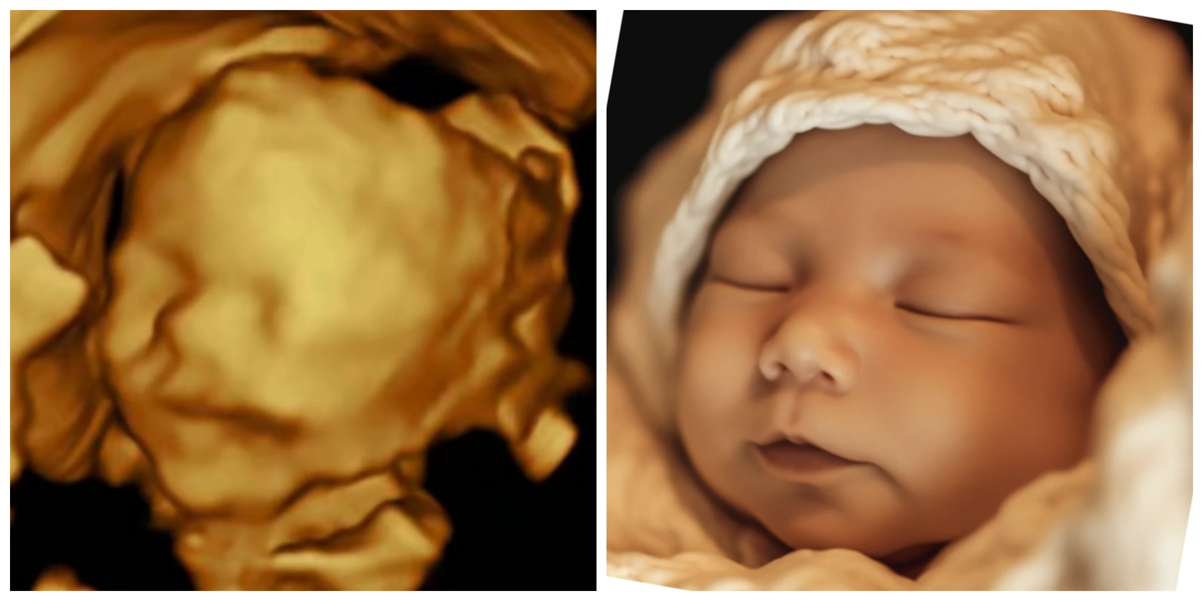 医用设备高清3D4D彩超机检查胎儿颈动脉便捷手提式彩超-阿里巴巴