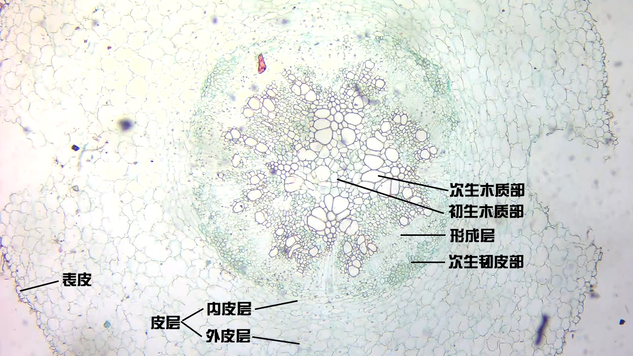 蚕豆根尖细胞图图片
