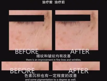 拒绝皱纹 想抗老 护肤品成分中的黄金搭档 会是你的指路明灯 哔哩哔哩