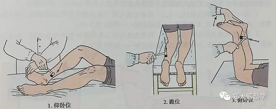 （3）跟腱反射： 叩诊锤叩击髌骨下的肱四头肌肌腱，出现轻微小腿屈曲