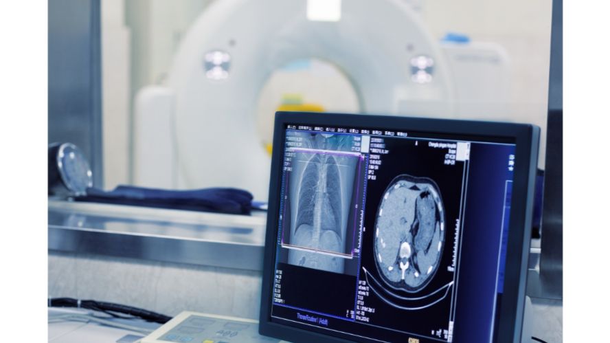 什么是DICOM格式医学影像？如何获取？ - 哔哩哔哩