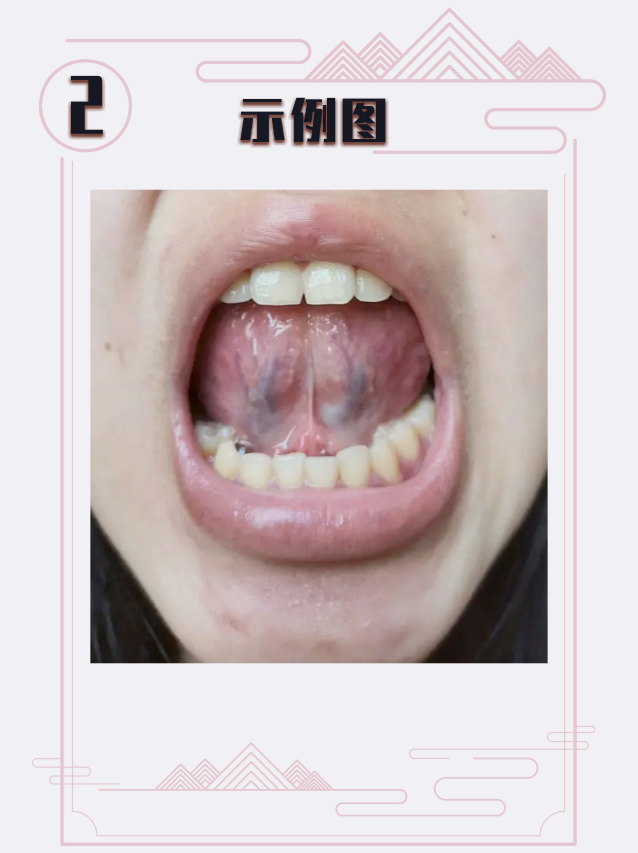 【3步,60秒内学会】拍舌象,应该是目前为止最简单易学的了【教程】 - 哔哩哔哩