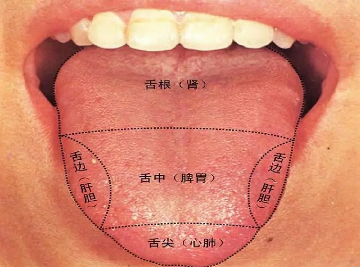 灼口综合征 中医舌苔辩证法 哔哩哔哩