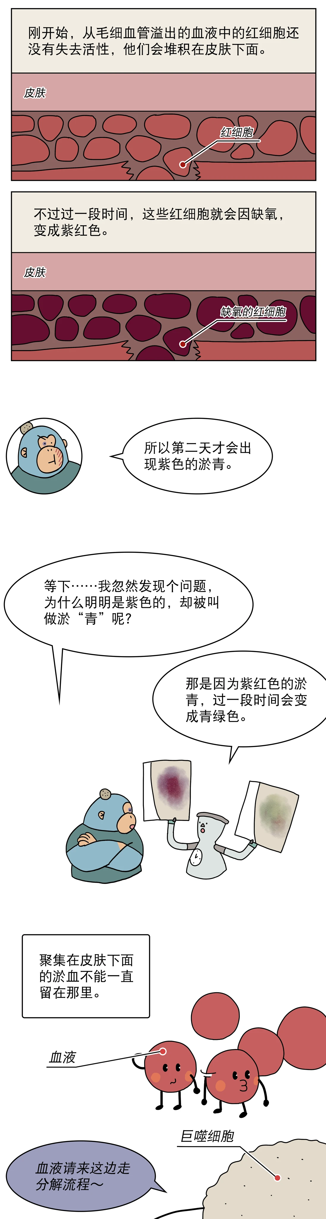 身上莫名其妙的淤青都是哪来的3